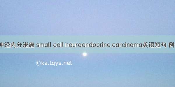 小细胞神经内分泌癌 small cell neuroendocrine carcinoma英语短句 例句大全