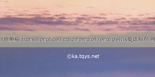 肾盂移行细胞癌 transitional cell carcinoma of renal pelvis英语短句 例句大全